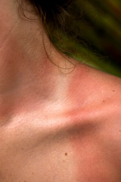 Патологические состояния кожи, вызывающие сыпь