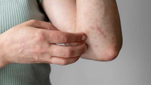 Пиритион цинка: лечение кожных заболеваний