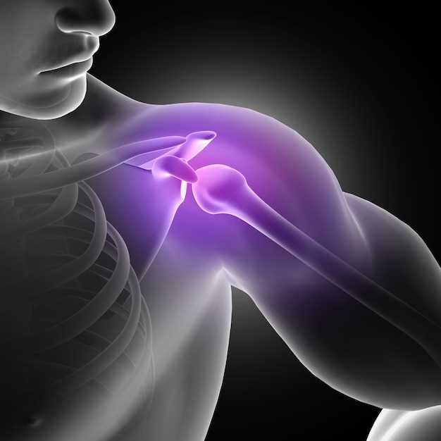 Что такое полиартроз плечевого сустава?