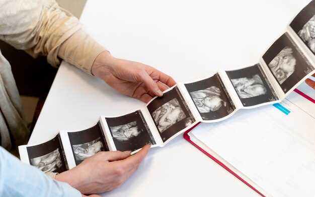 Во сколько недель можно определить пол эмбриона на узи